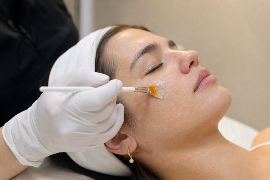 Hyperpigmentation Treatments That Correct, Prevent, and Last Christina Cosmeceuticals