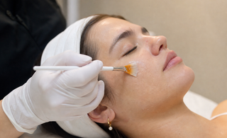 Hyperpigmentation Treatments That Correct, Prevent, and Last Christina Cosmeceuticals