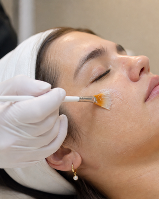 Hyperpigmentation Treatments That Correct, Prevent, and Last Christina Cosmeceuticals