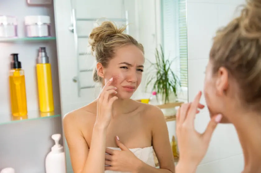 An Inside Look at Acne Christina Cosmeceuticals