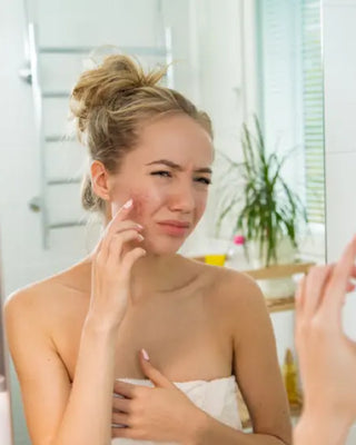 An Inside Look at Acne Christina Cosmeceuticals
