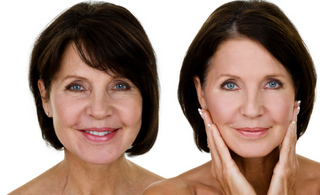 The 4 Different Wrinkle Types and How to Treat Each One