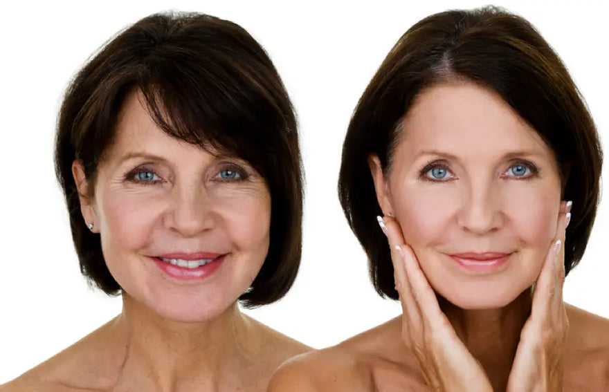 The 4 Different Wrinkle Types and How to Treat Each One Christina Cosmeceuticals