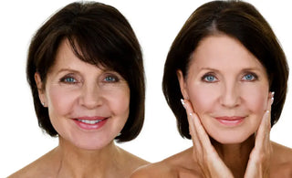 The 4 Different Wrinkle Types and How to Treat Each One Christina Cosmeceuticals