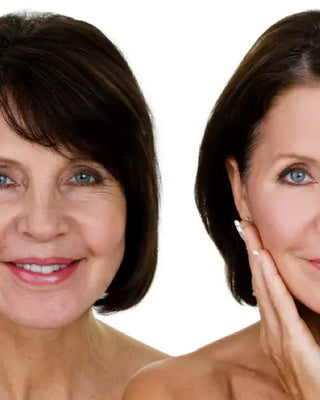 The 4 Different Wrinkle Types and How to Treat Each One Christina Cosmeceuticals