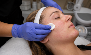 How to Choose Professional Acne Skincare Without Guesswork Christina Cosmeceuticals