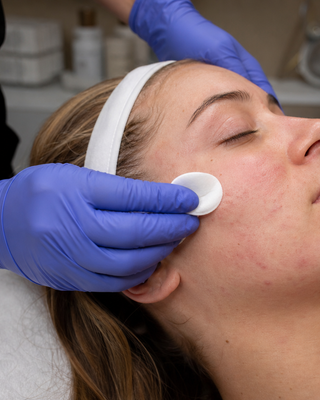 How to Choose Professional Acne Skincare Without Guesswork Christina Cosmeceuticals